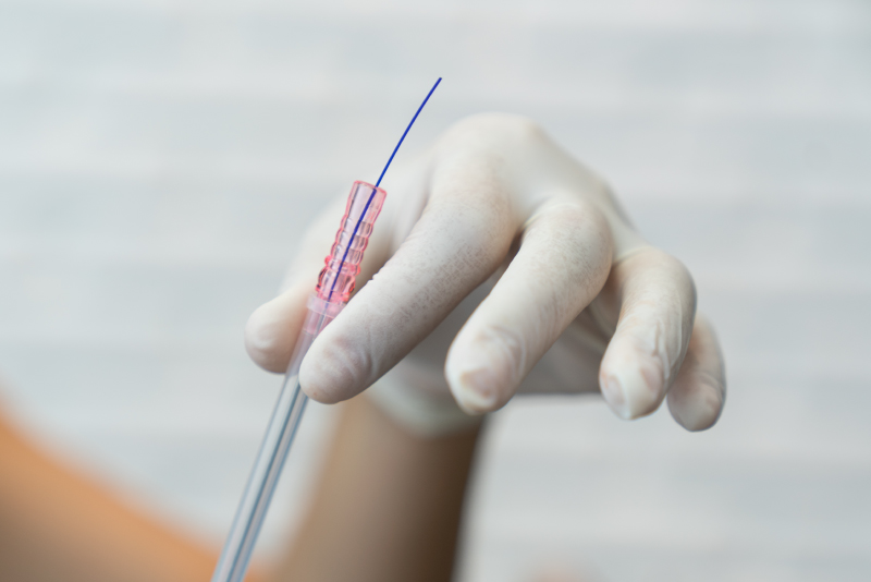 Gloved hand holding a single PDO thread needle, highlighting the thin blue thread used for lifting.