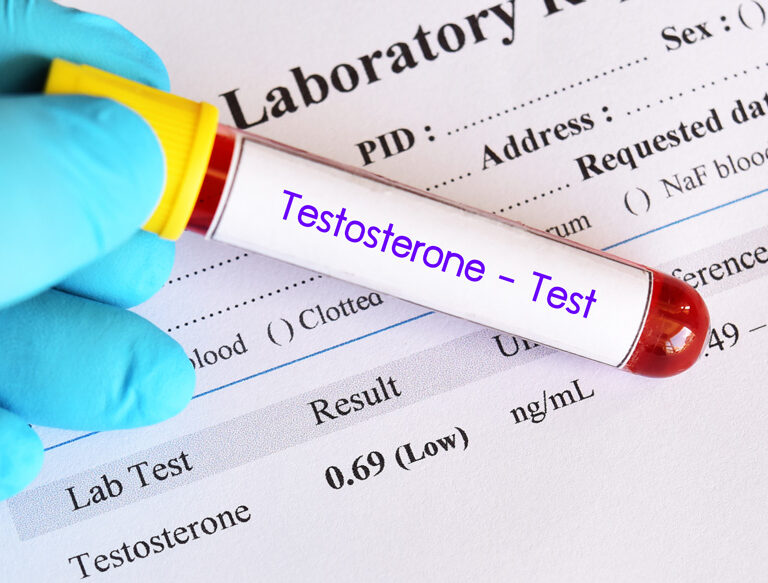 potential Insurance risks associated with Testopel