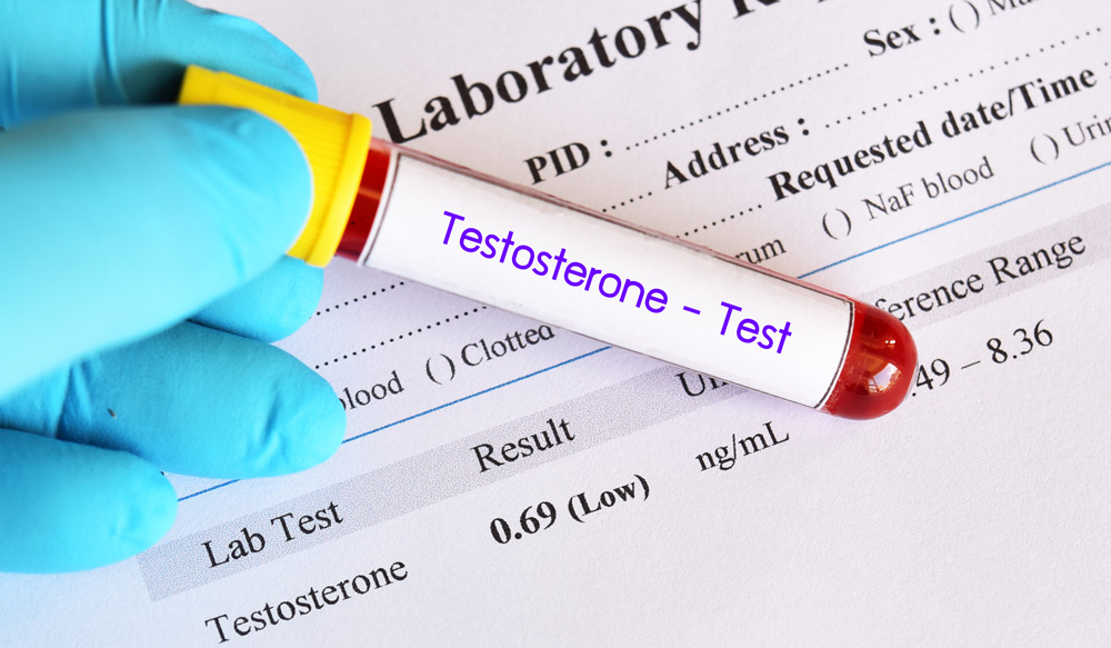 potential Insurance risks associated with Testopel